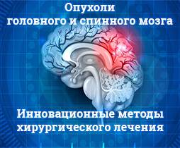 Опухоли головного и спинного мозга