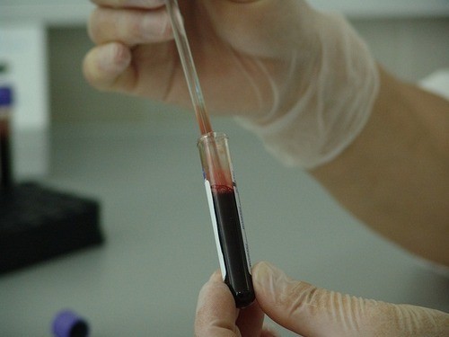 blood-20745_640_500x375.jpg blood-20745_640_500x375.jpg