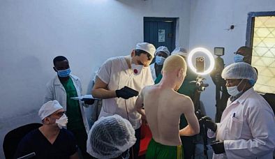 «Живи без страха»: врачи онкоцентра имени Н.Н. Блохина проводят раннюю диагностику меланомы у альбиносов Конго