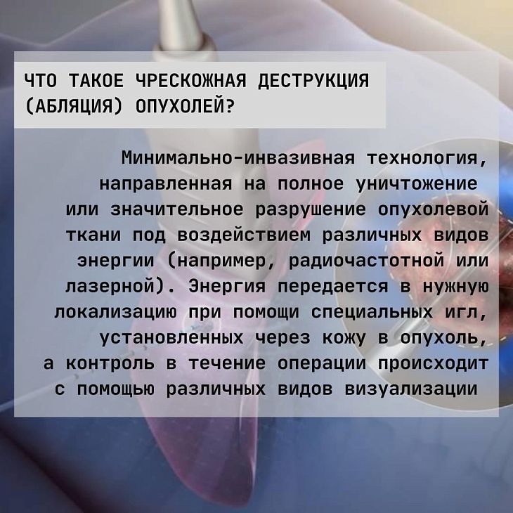 Криоабляция опухолей под ПДКТ-контролем: что нужно знать?