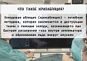 Криоабляция опухолей под ПДКТ-контролем: что нужно знать?