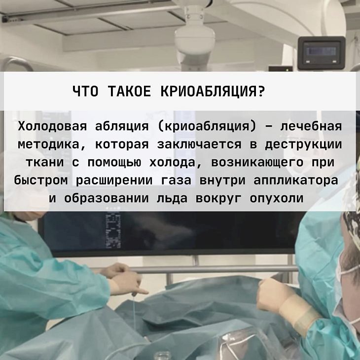 Криоабляция опухолей под ПДКТ-контролем: что нужно знать?