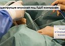 Криоабляция опухолей под ПДКТ-контролем: что нужно знать?